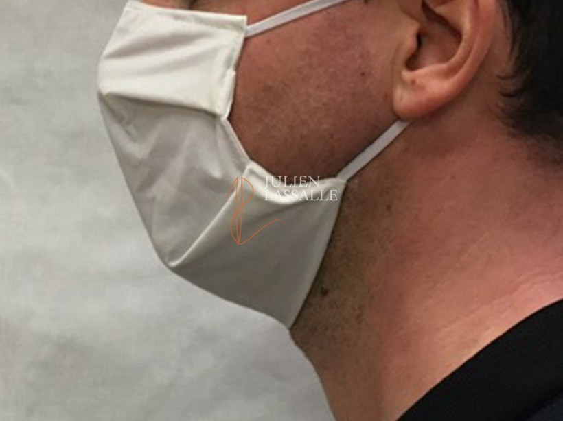 Masque barrière AFNOR SPEC S76-001 tissus technique catégorie 2